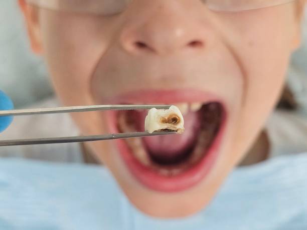 Best Emergency Orthodontic Repairs in St Charles, MI